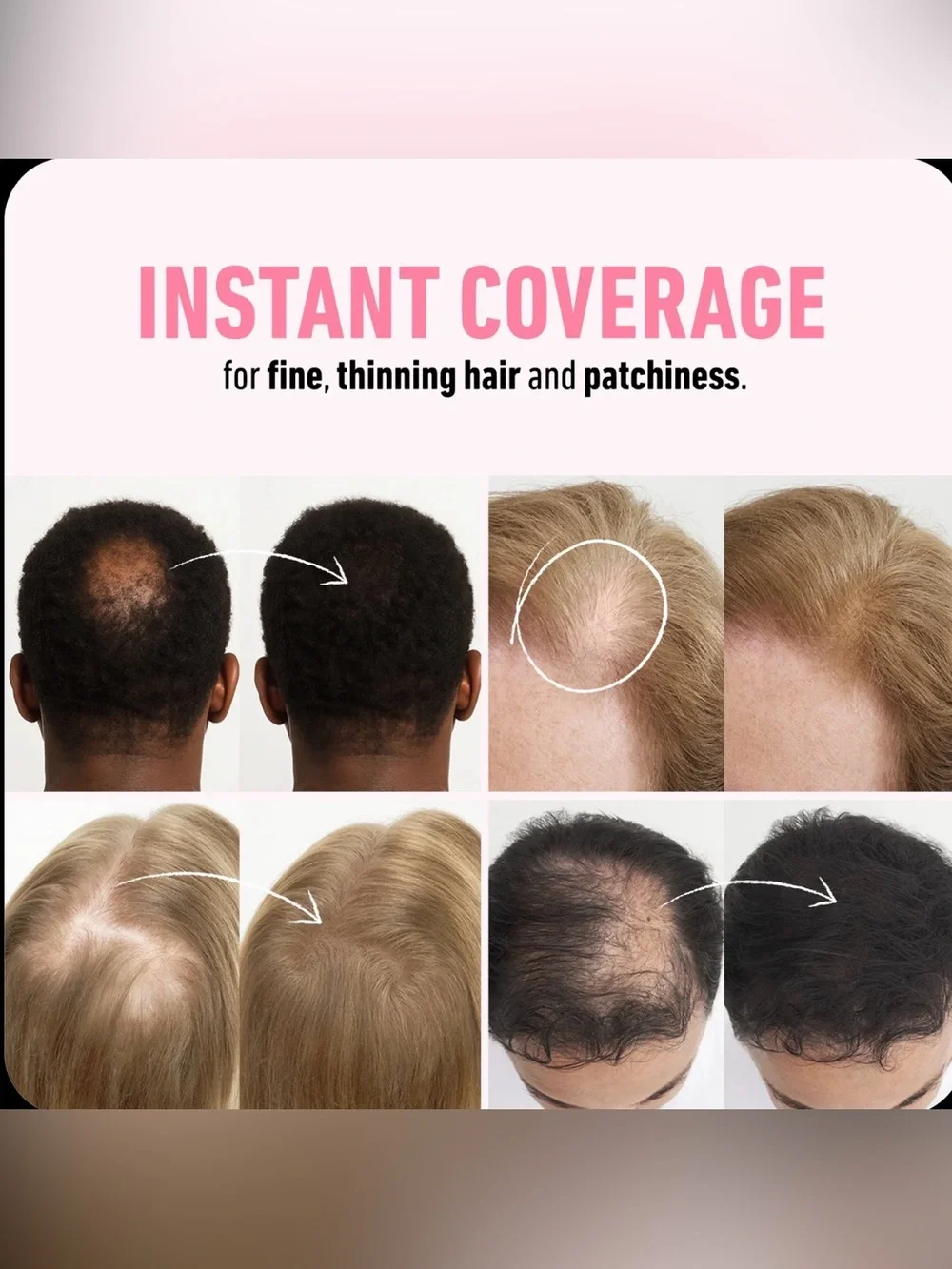 Boldify Hair Thickening Fibers for Thinning Hair - Dark Blonde- New